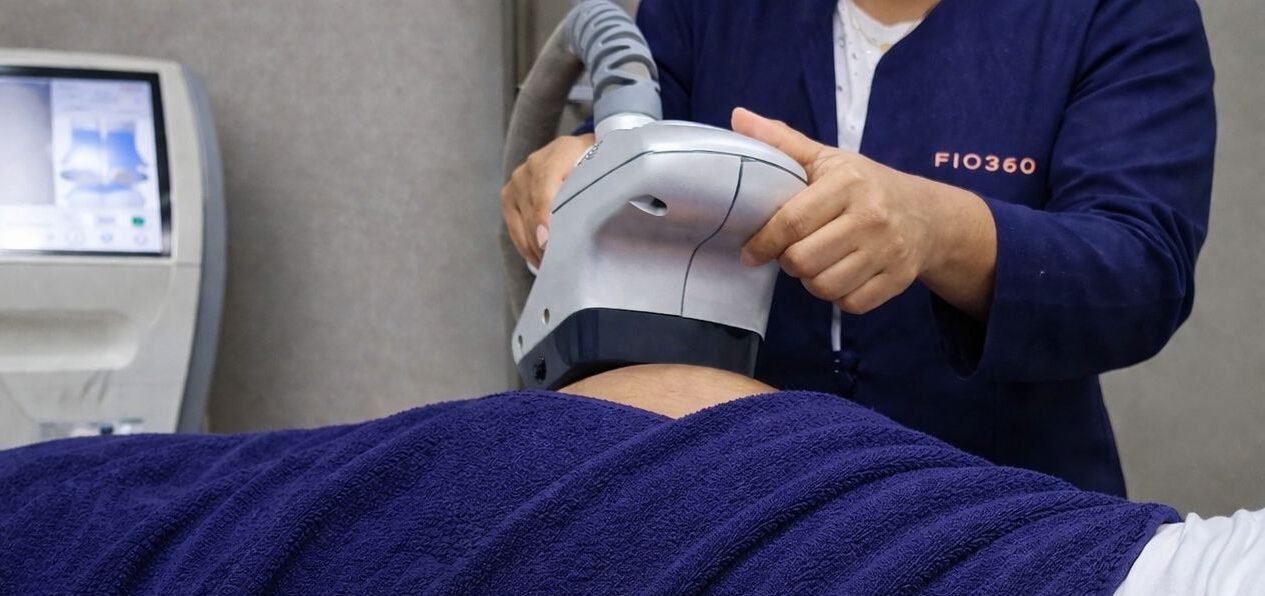 Velashape II