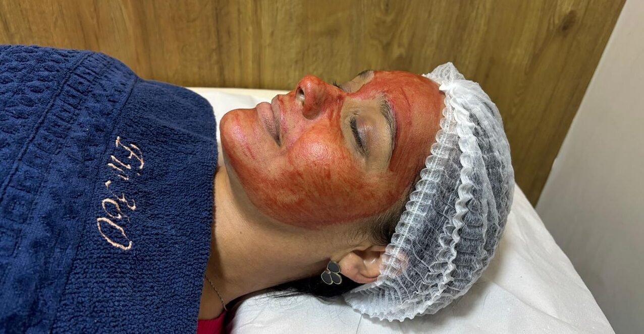 Nutrição Facial