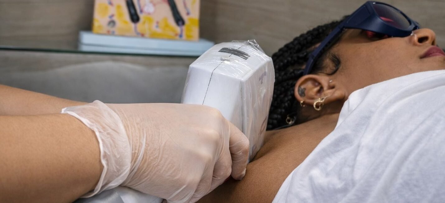 Depilação a laser